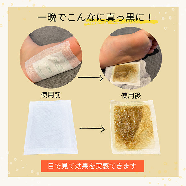 足裏樹液シート 足かるっシート 15セット（30枚入り）むくみ・冷え対策 日本製 高麗人参・ゲルマニウム配合 フットケア リラックス