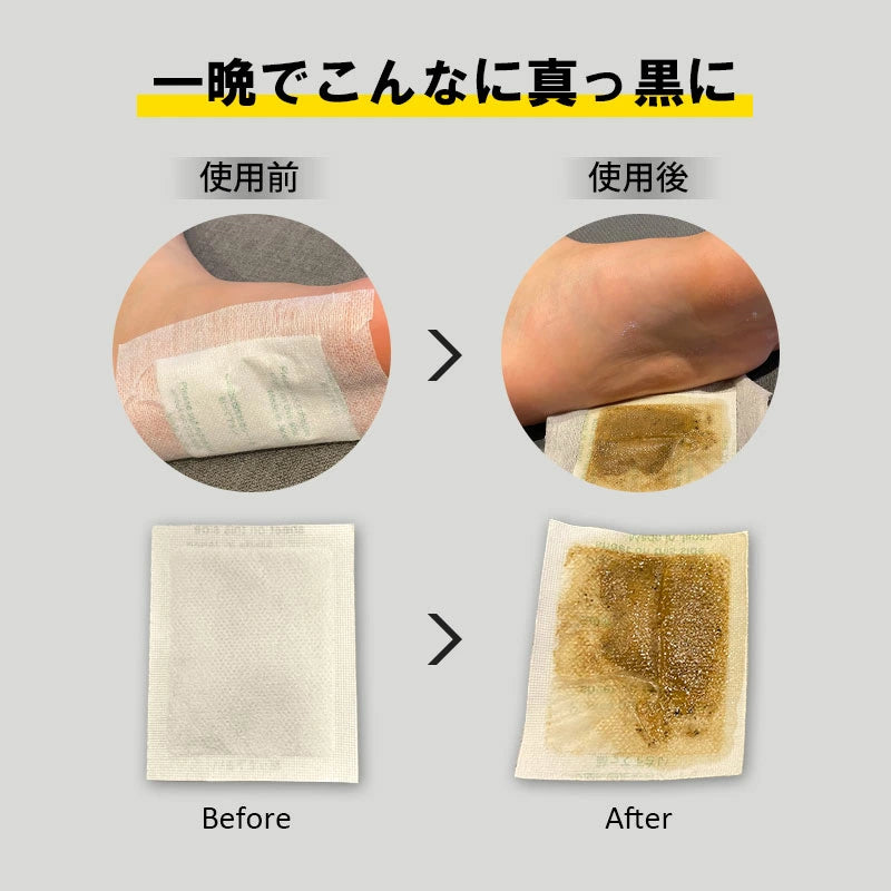 足裏樹液シート 足かるっシート 15セット（30枚入り）むくみ・冷え対策 日本製 高麗人参・ゲルマニウム配合 フットケア リラックス